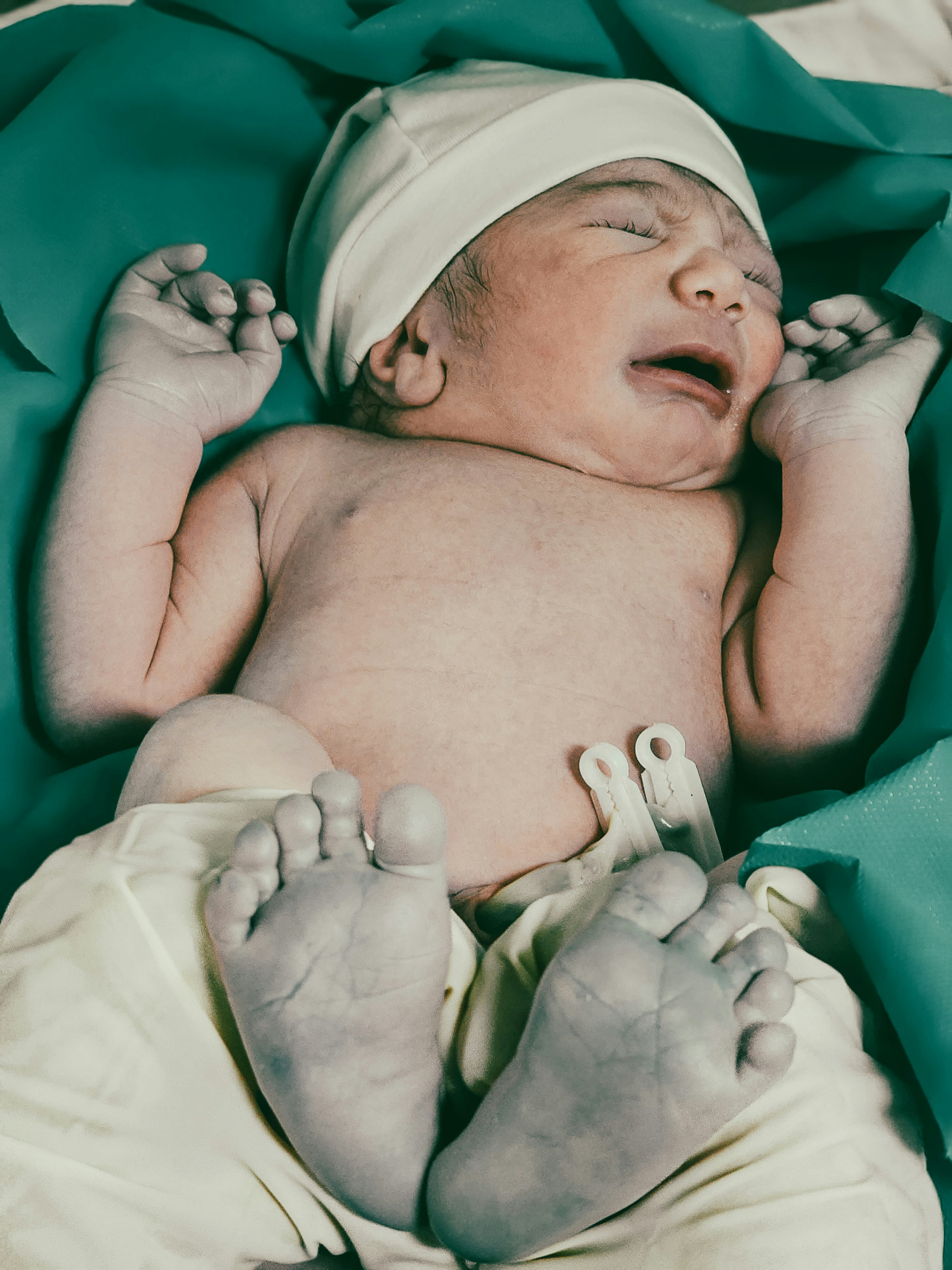 A newborn baby cries immediately after birth.