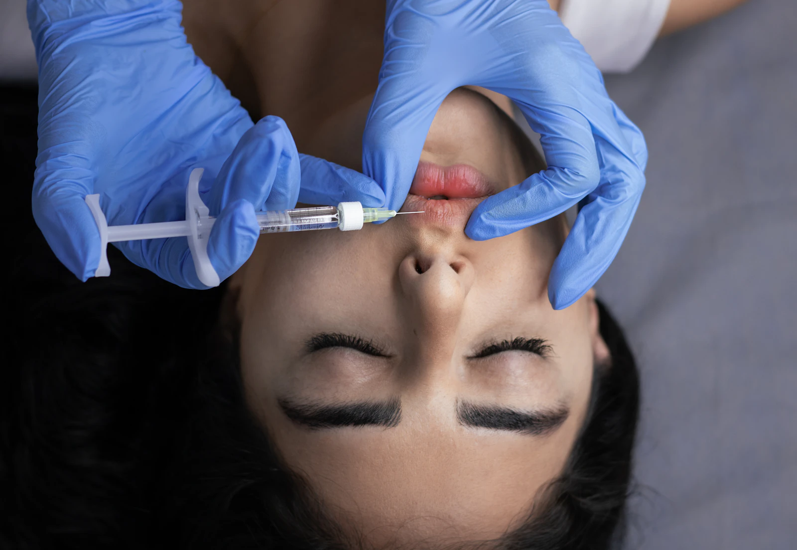 Close-up of lips receiving a cosmetic filler injection — warm natural light and calm, elegant styling