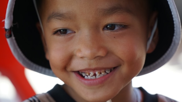 A happy boy smiles with missing teeth.