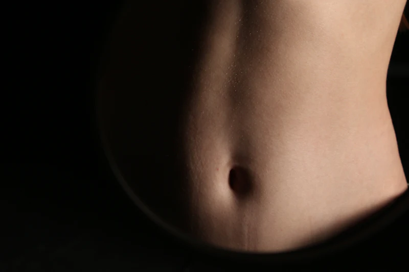 Abdominal diastasis endoscopic repair