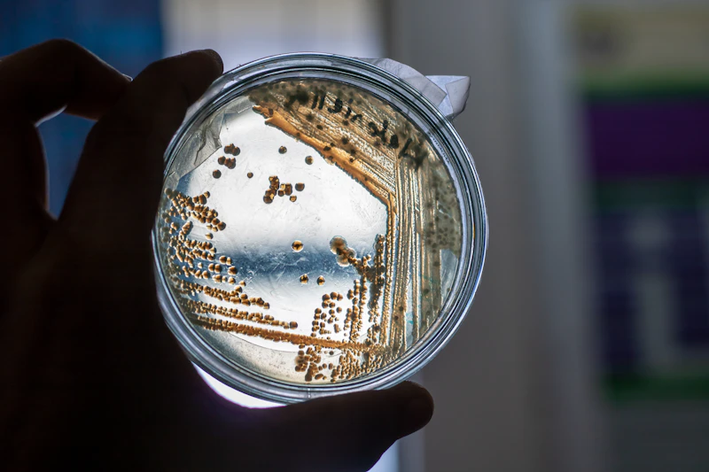 Petri dish culture held for laboratory inspection