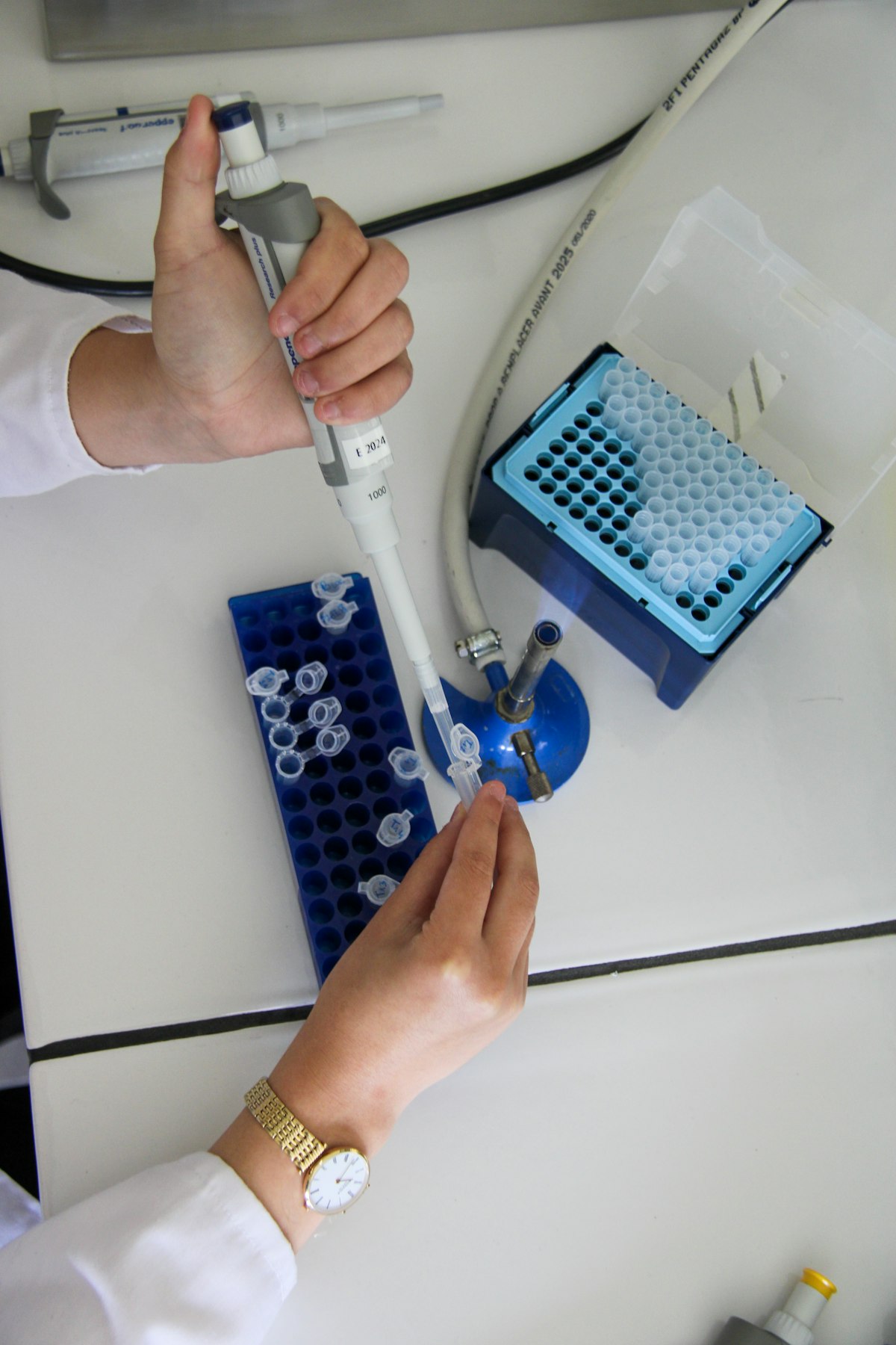 Laboratory technician transferring a clinical sample at a reference lab bench.