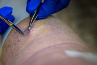 Surgeon is using tools to stitch a wound.