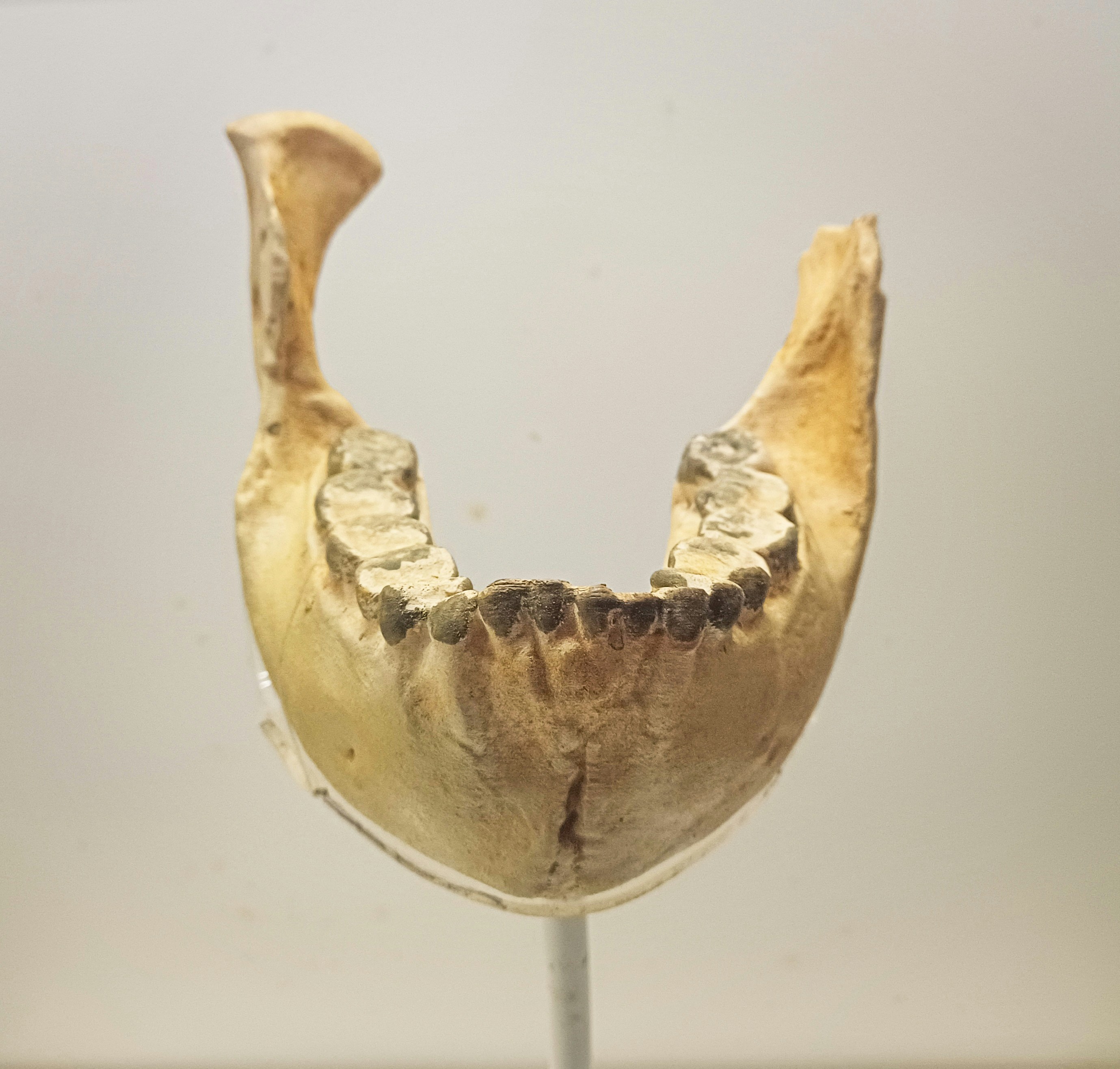 A human jawbone with teeth is shown.