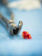 Extracted tooth with dental pliers on a surgical cloth.