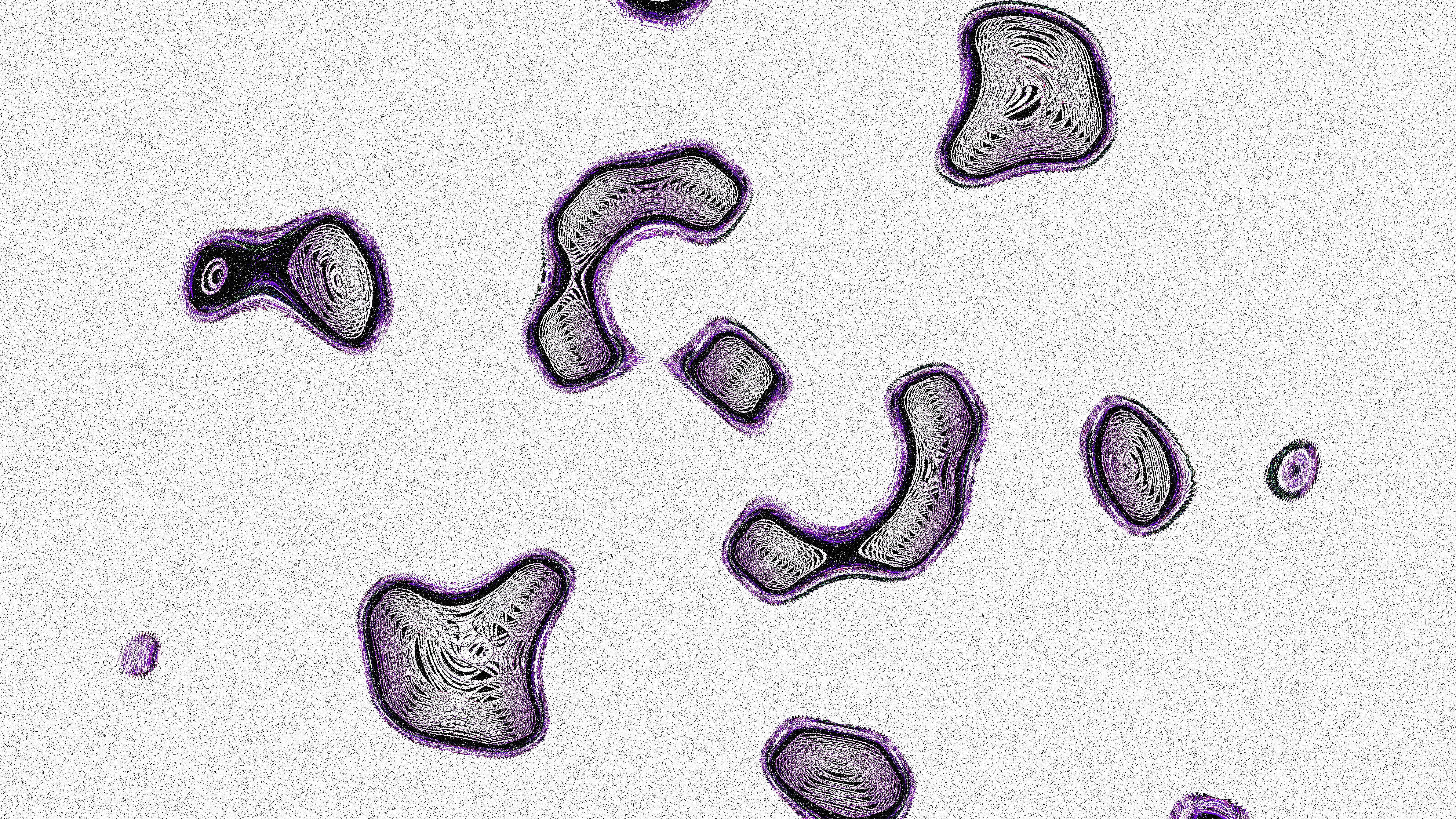 High Neutrophil Extracellular Trap Levels Associated With Lower Functional Independence After Thrombectomy in Stroke