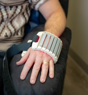 Man's arm with medical device attached