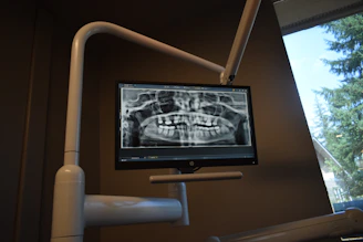 Dental x-ray displayed on a monitor in a clinic.
