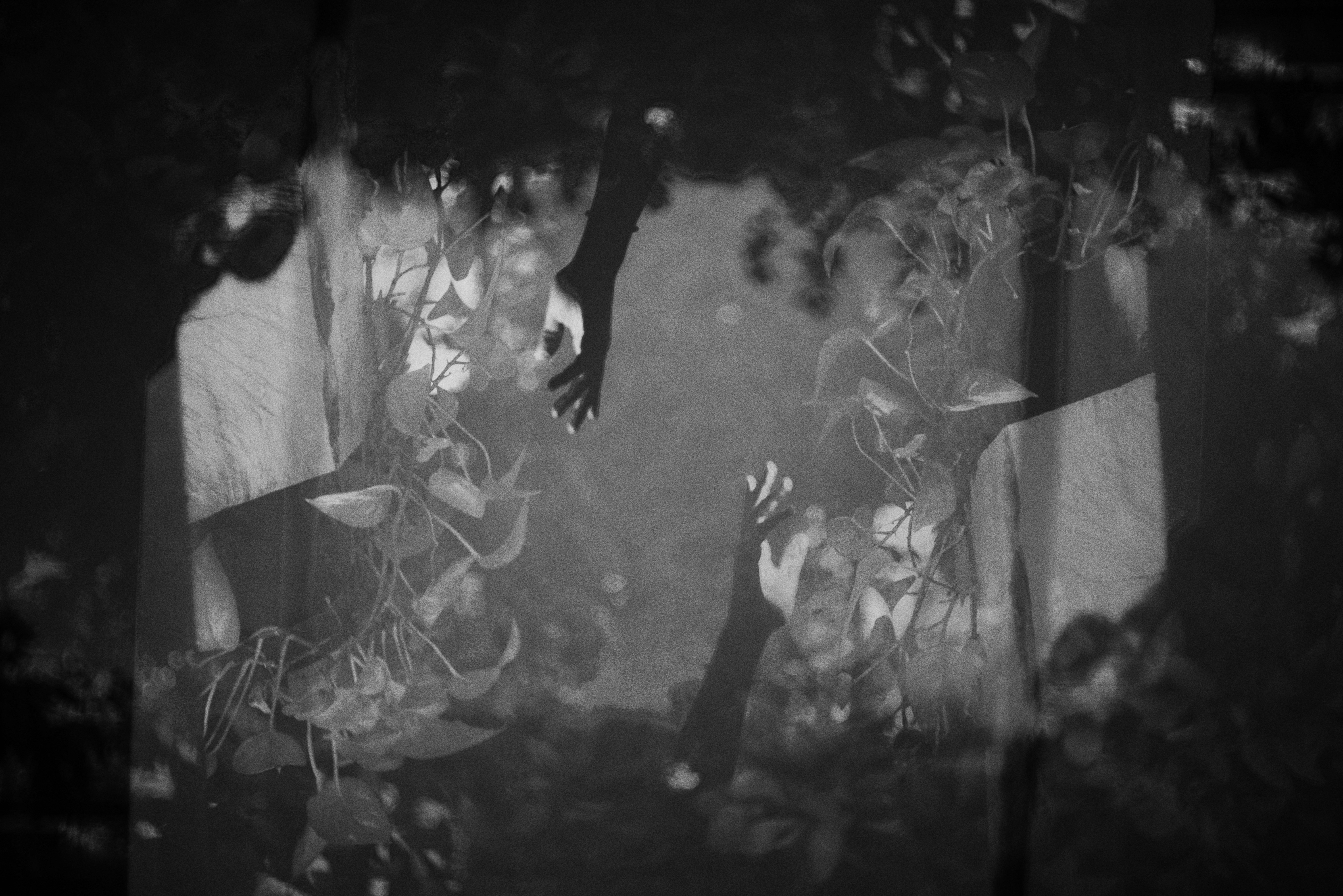 Checking Out The Conveniences Of Glaucoma Surgical Treatment For Vision Conservation: Secret Insights Provided