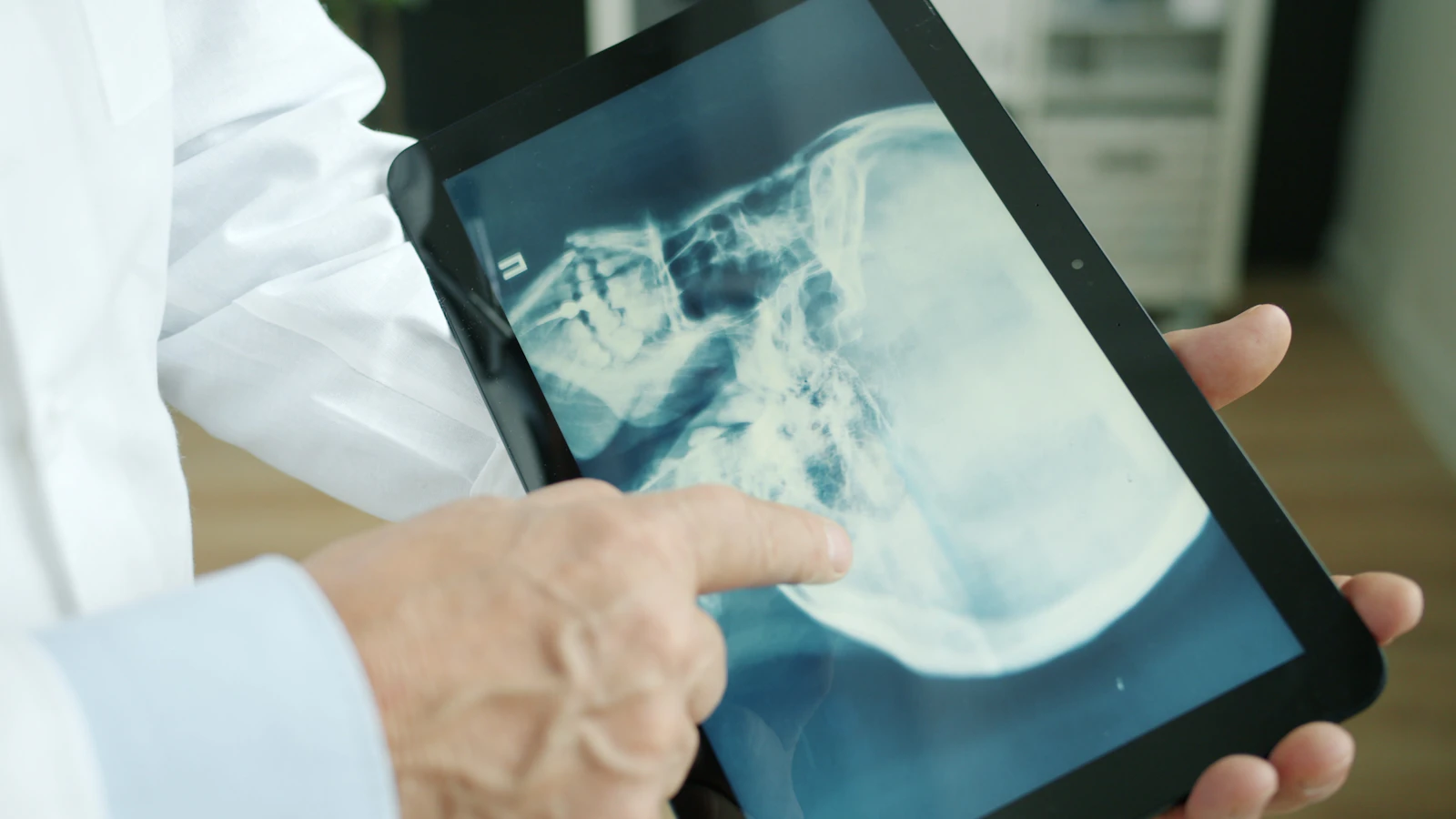 Doctor pointing at an x-ray on a tablet