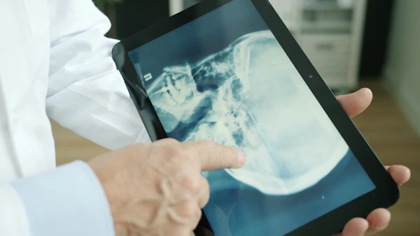 Digital Marketing for Healthtech Startups: Where to Begin — related Care Tech article
