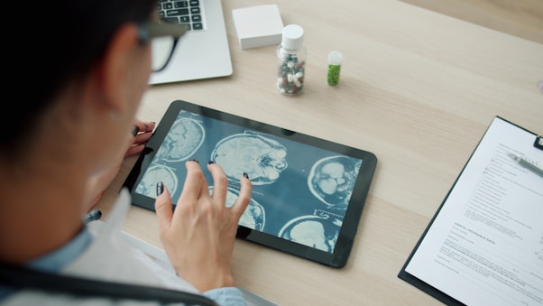 Doctor examining mri scans on a tablet screen