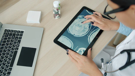Doctor examining brain scan on tablet at desk.