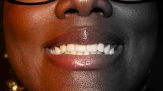 Close-up of a woman's mouth with teeth showing