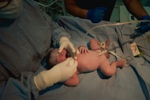 Newborn baby being attended to by medical professionals.