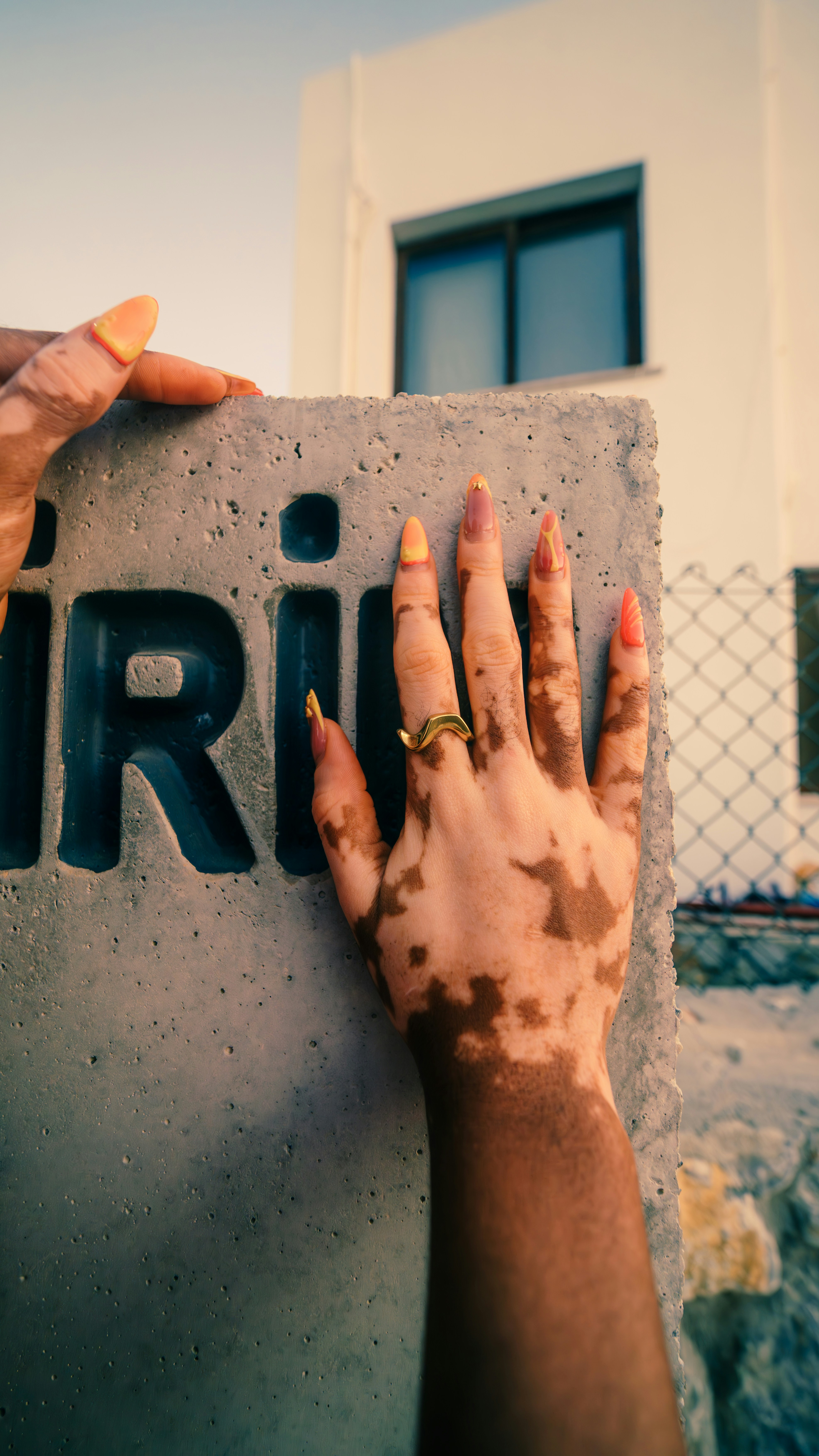 Hand with vitiligo touching concrete with letters