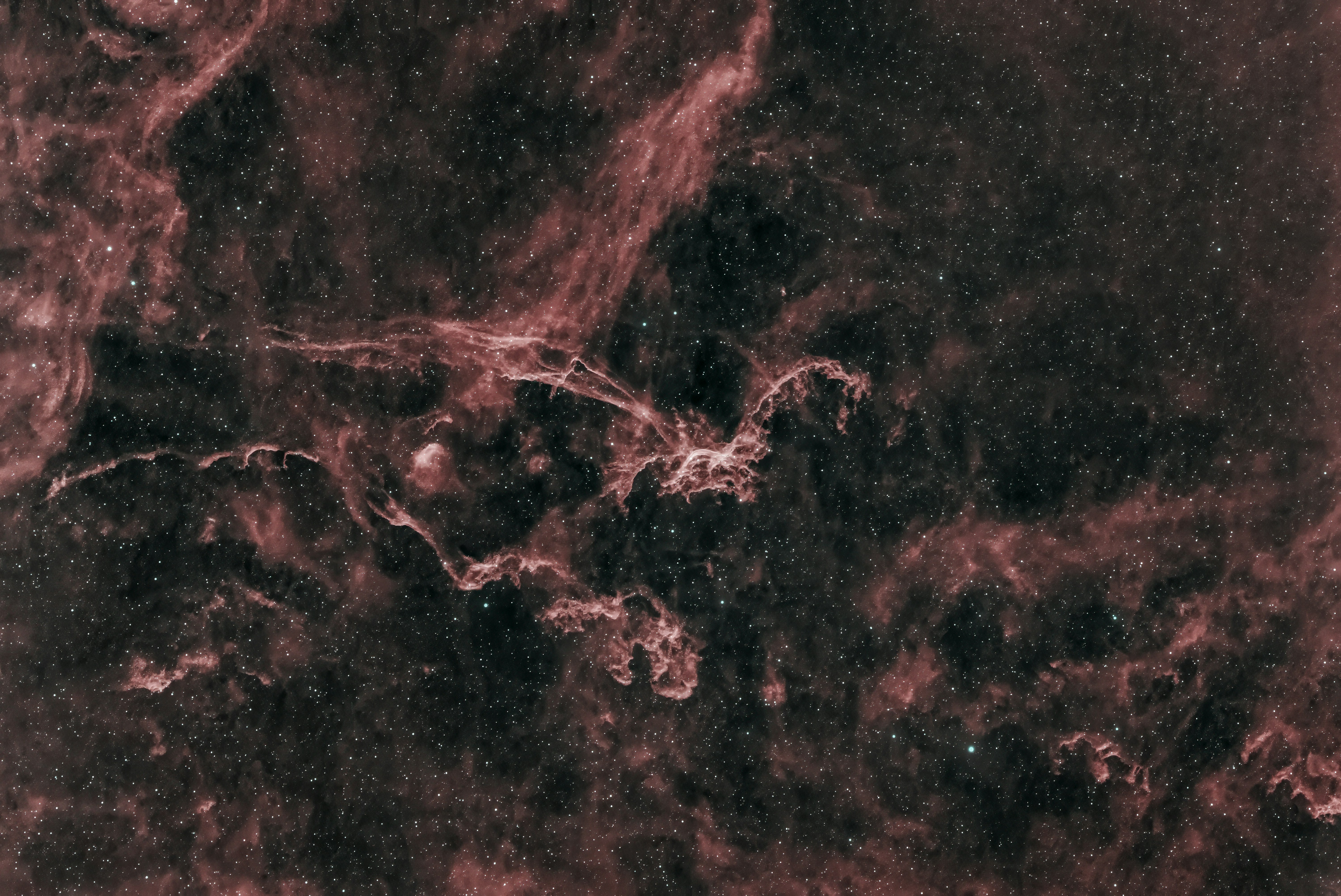 Check Out The LASIK Trip, Beginning With The Initial Assessment To The Recovery Stage, And Reveal The Surprises That Lie Ahead