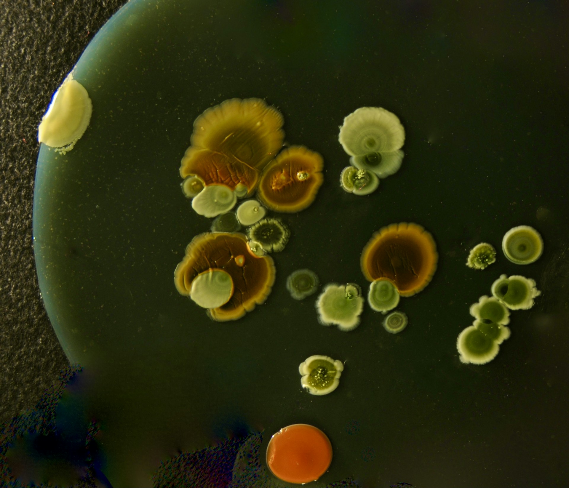 Colorful bacterial colonies growing on a dark surface.