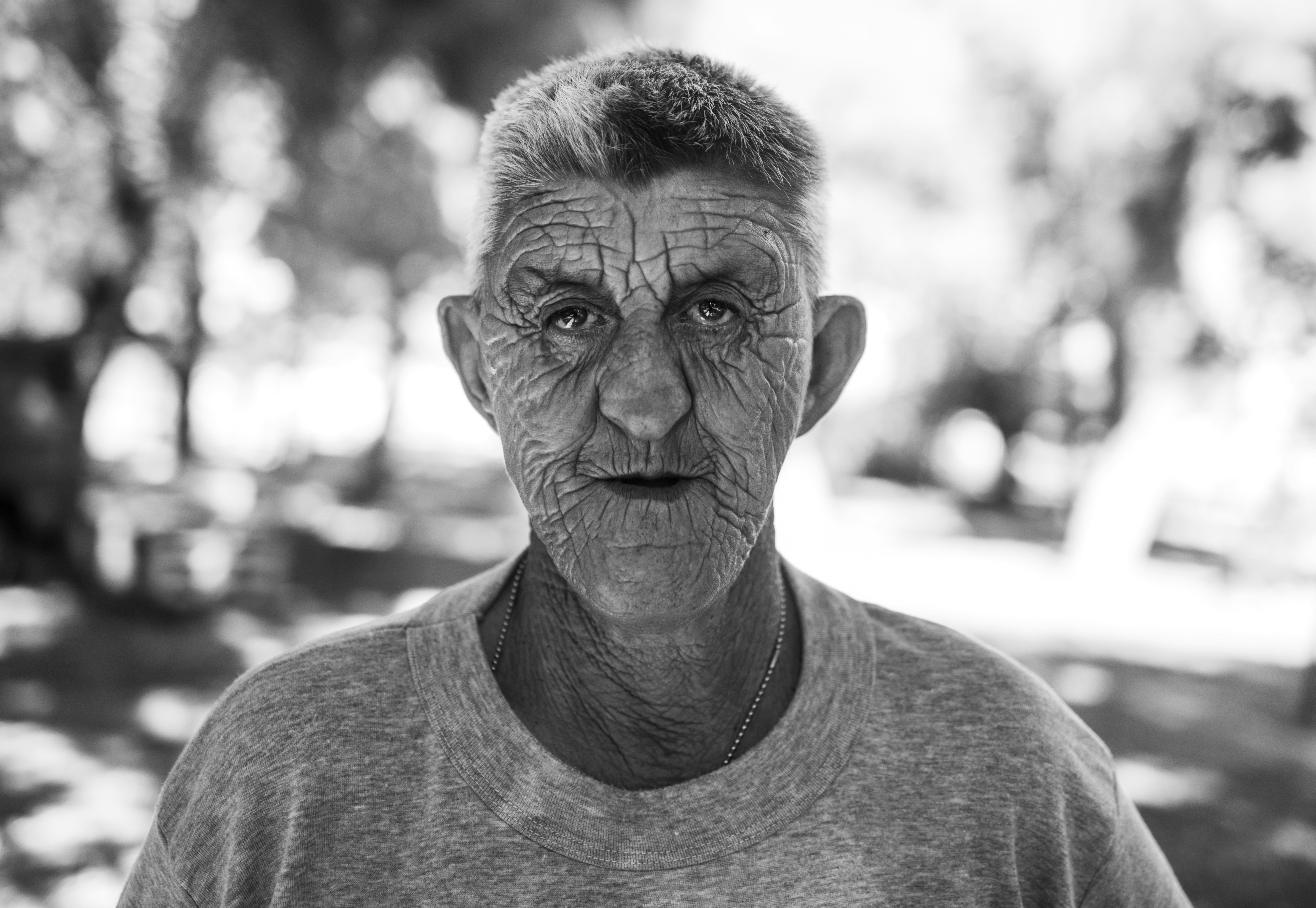 aging concerns face - best alternative to surgical facelift