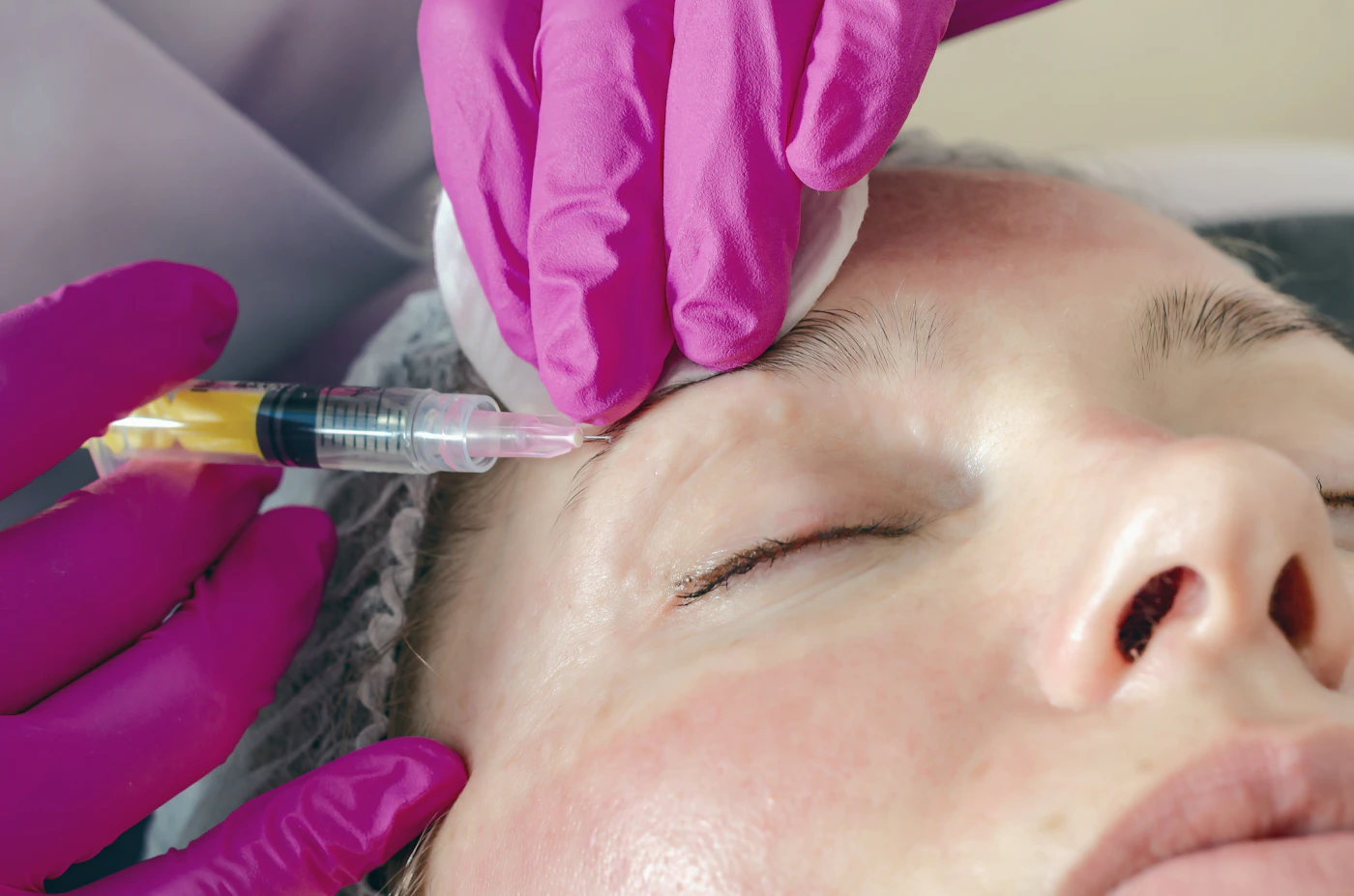 Person receiving a cosmetic injection in their forehead at a clinic