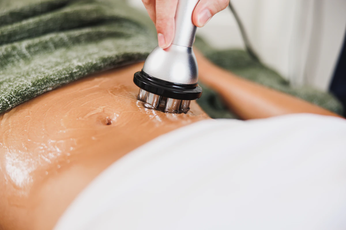 Woman receiving an RF body skin tightening treatment on the abdomen