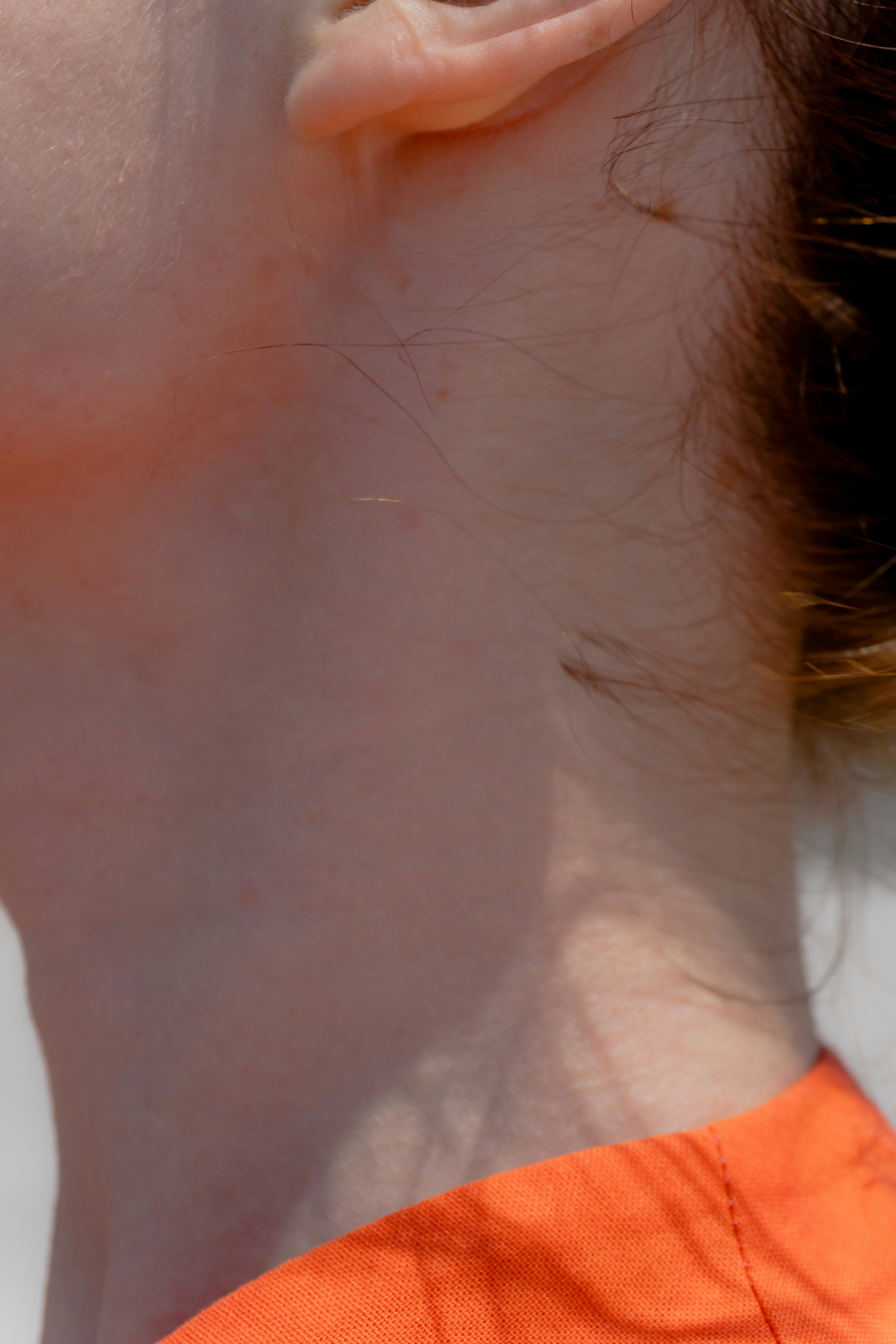 minimalist skin texture, wallpaper, Acne Treatment: 10 Years of Lessons Learned 3