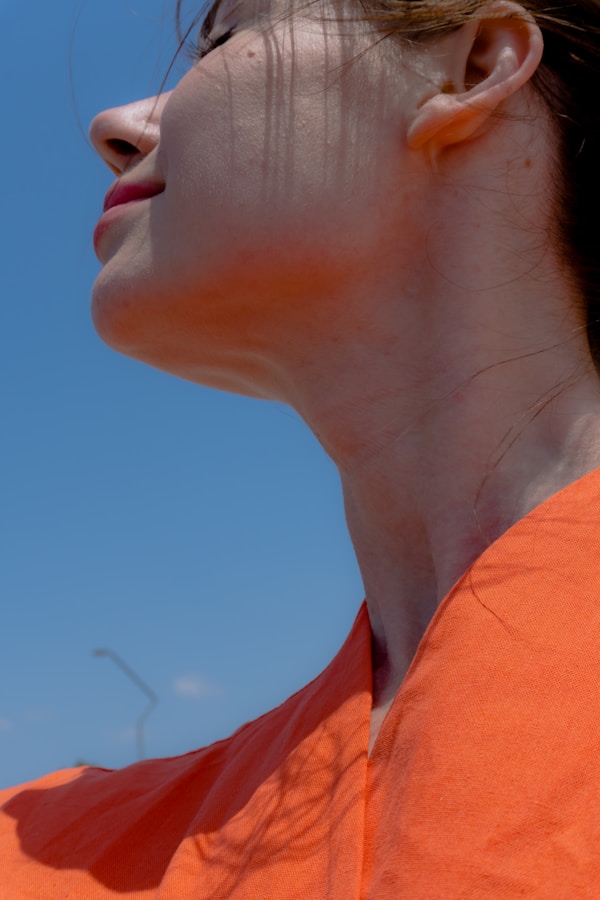 J.R. — before and after Morpheus8 jawline treatment