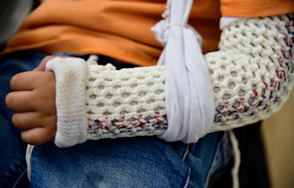 Child's arm in a colorful cast