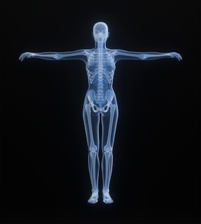 X-ray of a human skeleton against black background