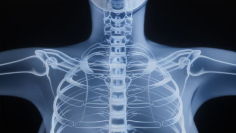 X-ray of a human torso and shoulders