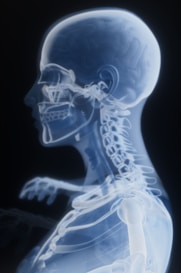 Medical X-ray of head and cervical spine representing spinal rehabilitation.