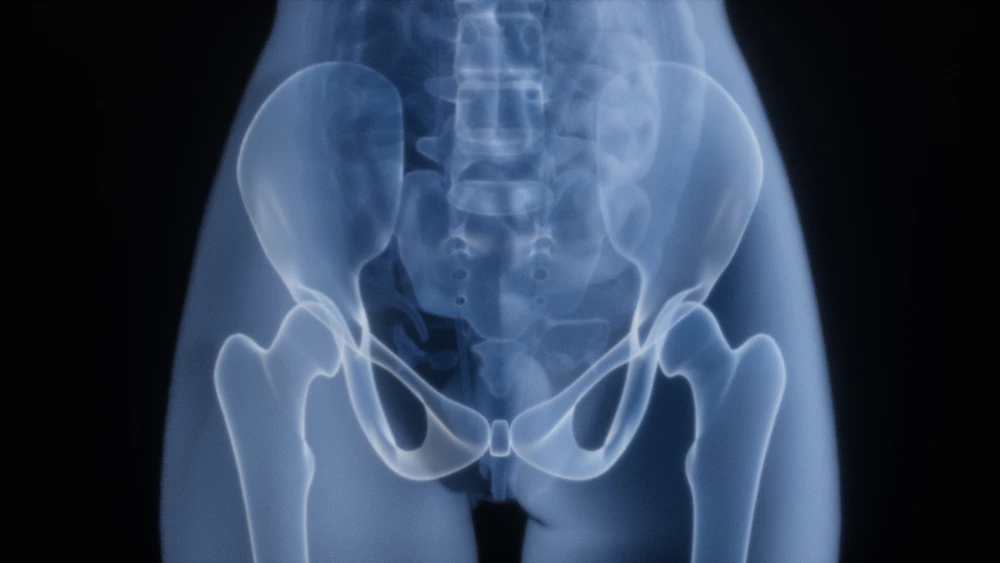 X-ray of a human pelvis and hip joints