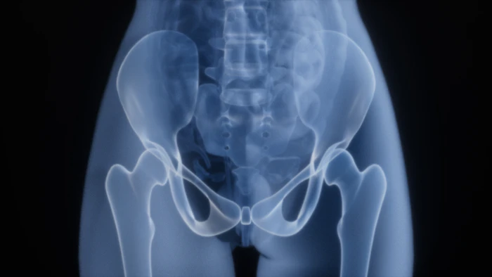 X-ray of a human pelvis and hip joints