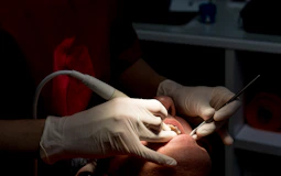 Dentist cleaning patient's teeth with tools.