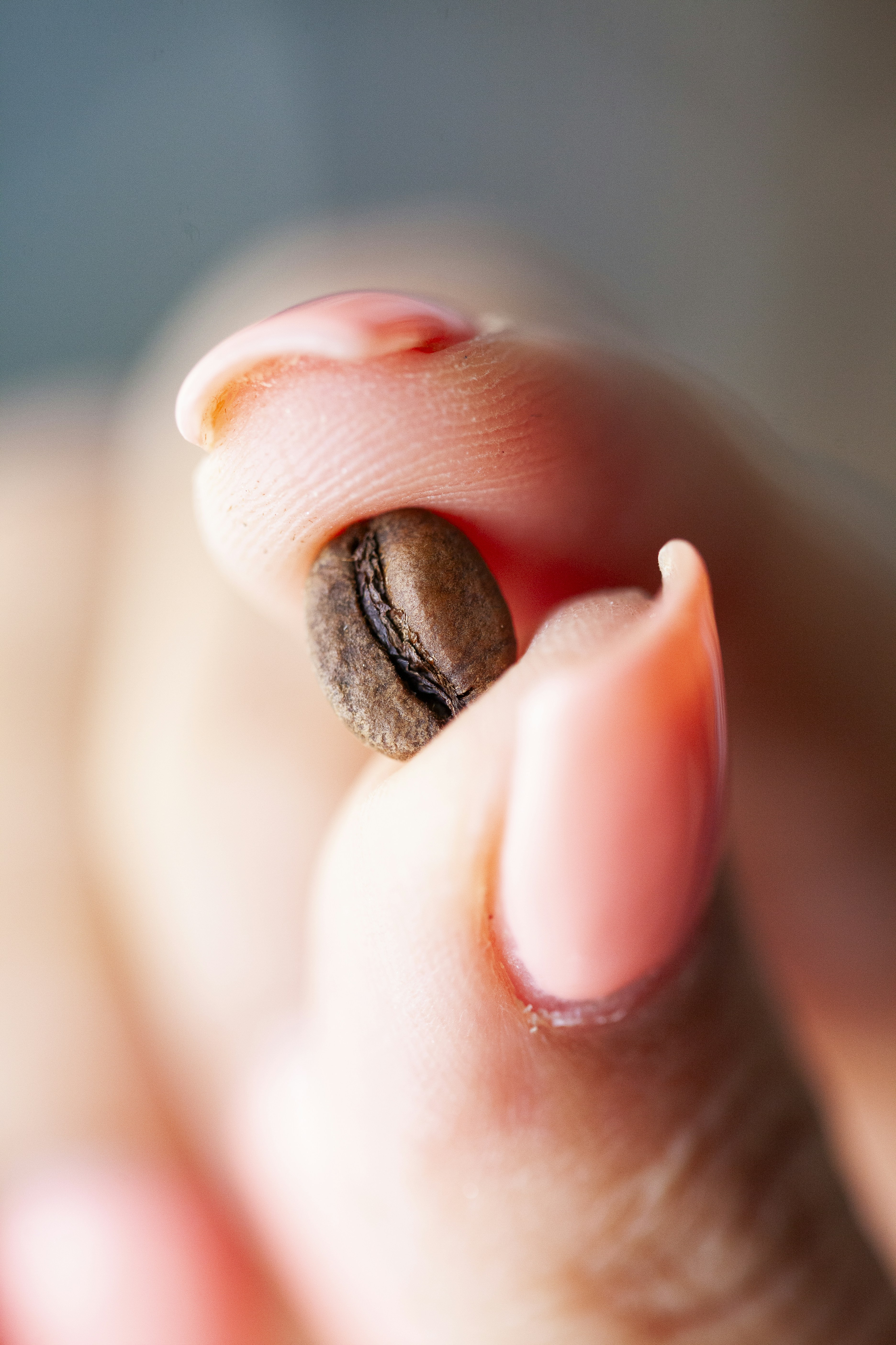 손톱 검은 세로줄 흑색종 의심 증상 및 단순 색소 침착과의 차이점 확인 이미지1