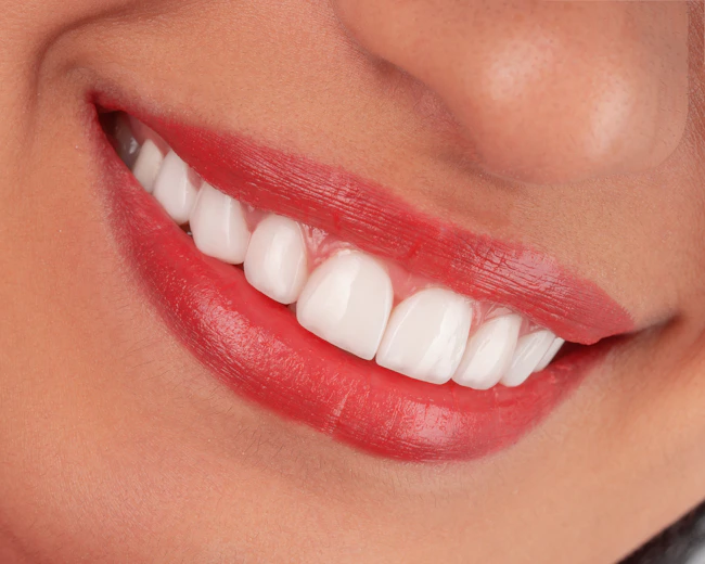 Close-up of a woman's smiling mouth with red lipstick.