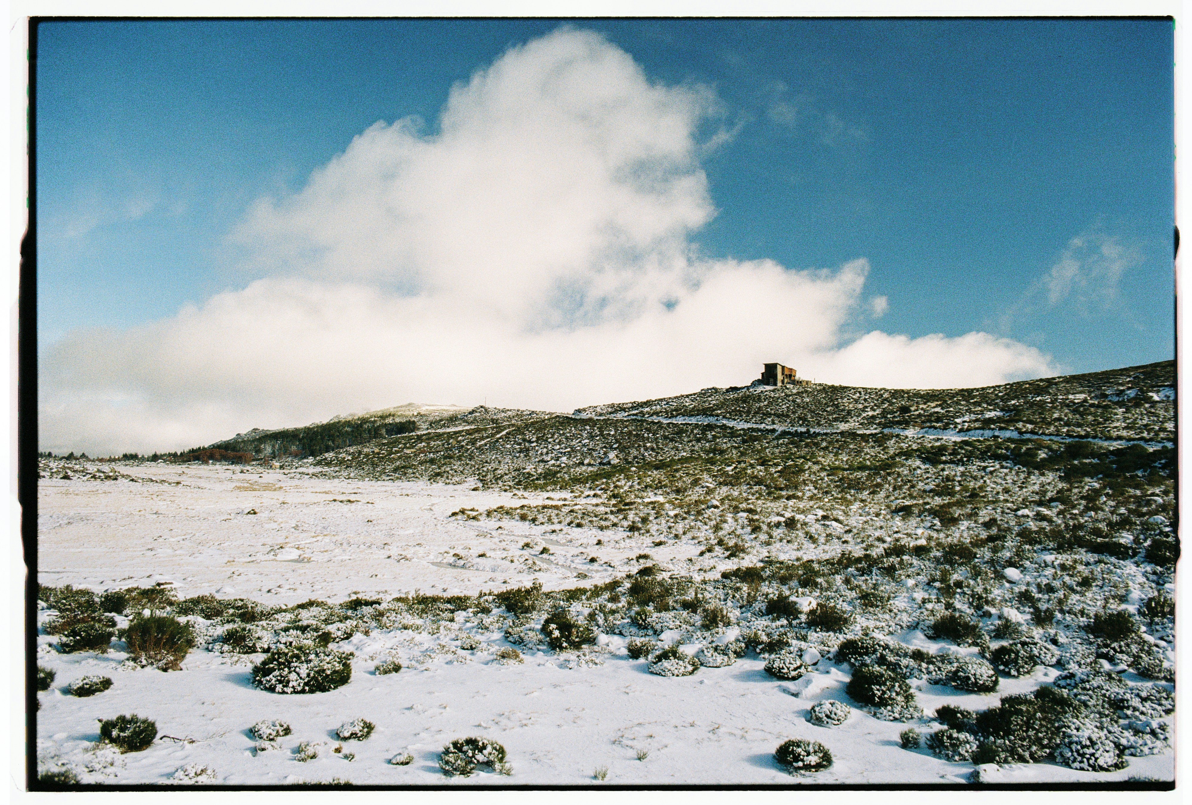 That Is A Good Prospect For Refractive Lens Exchange?
