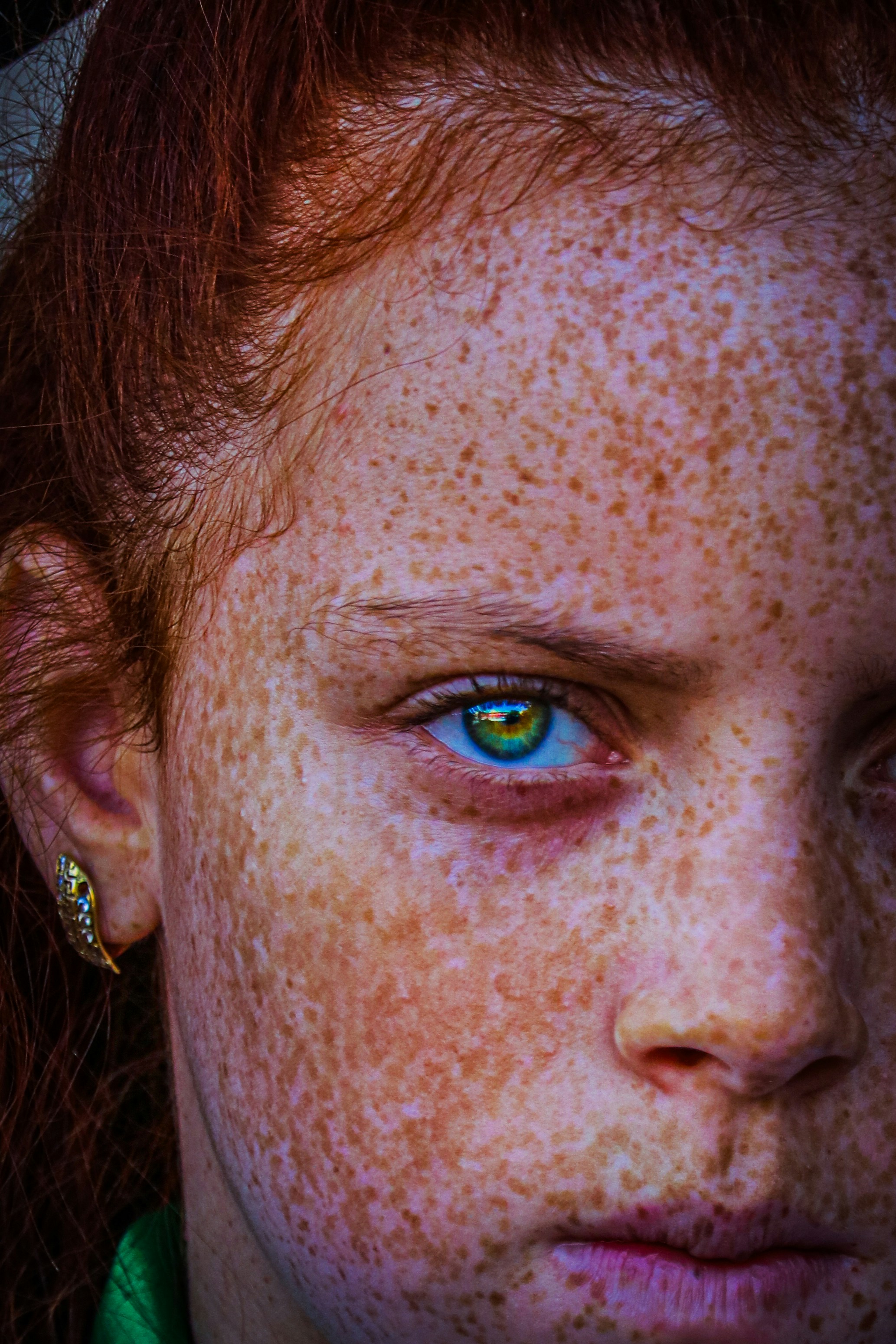 red skin texture, wallpaper, Bintik Merah di Telapak Tangan, Ini Penyebabnya 5