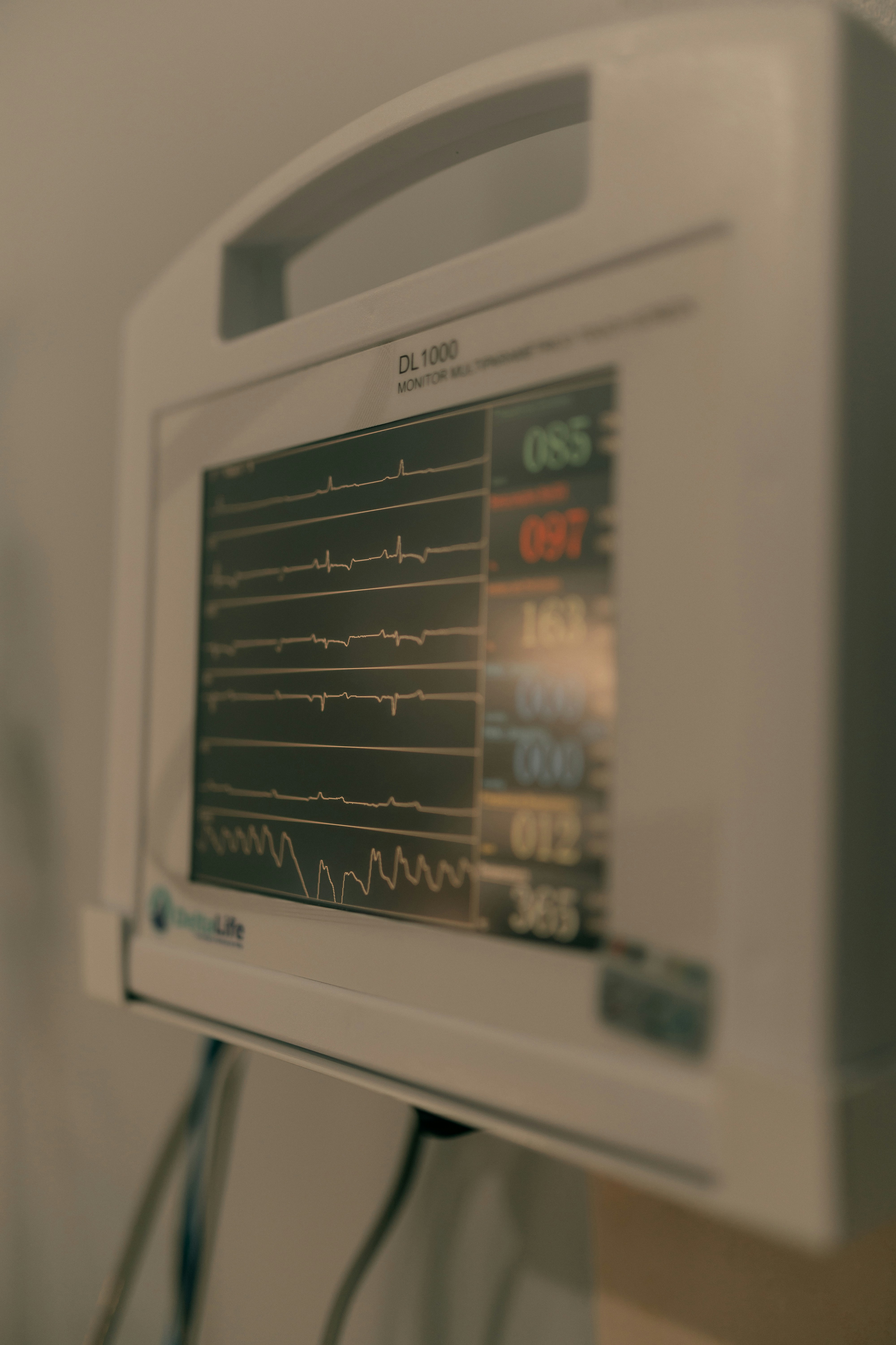 Close-up of a medical monitor displaying vital signs.