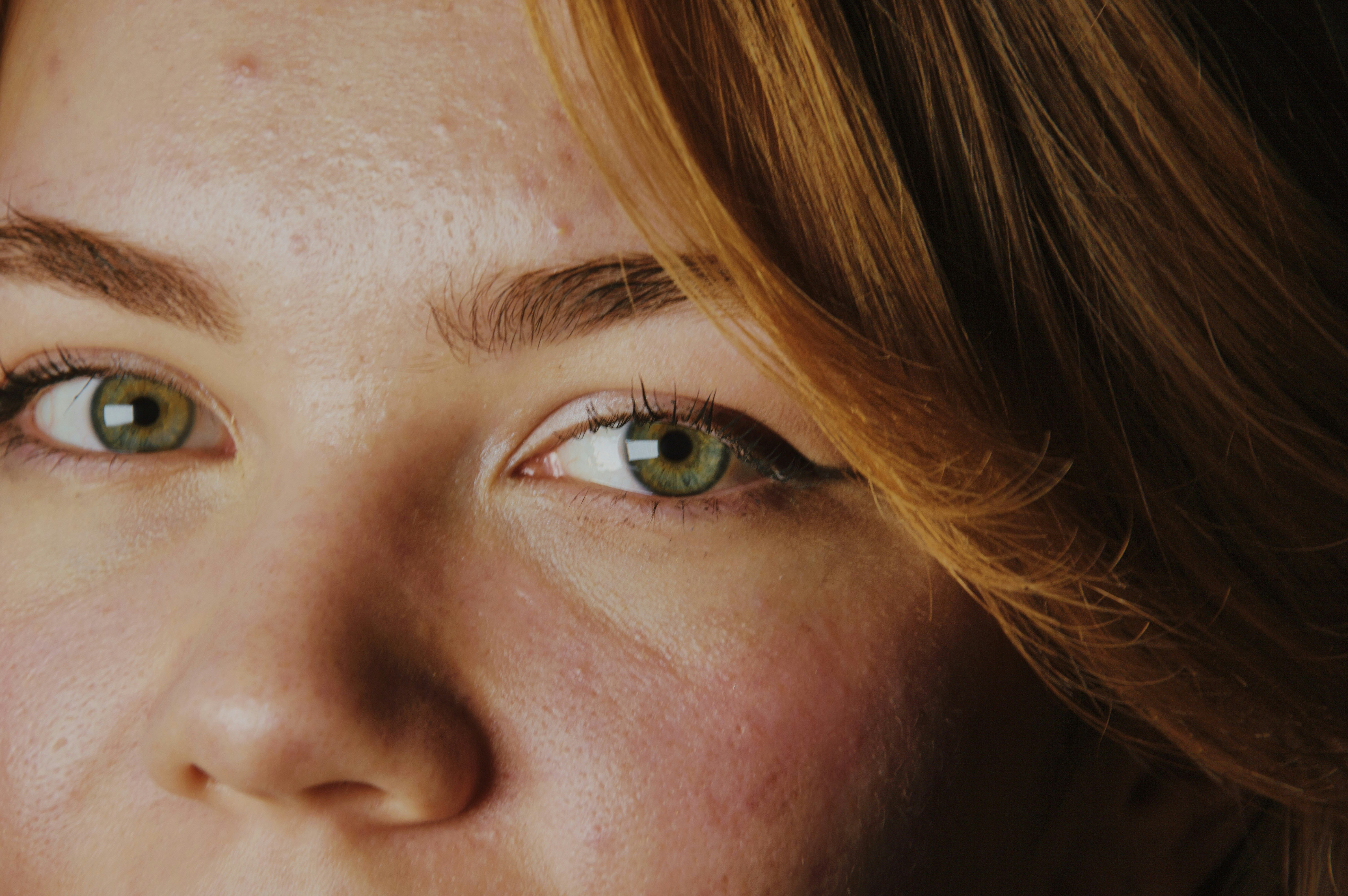 red skin texture, wallpaper, Bintik Merah di Telapak Tangan, Ini Penyebabnya 4