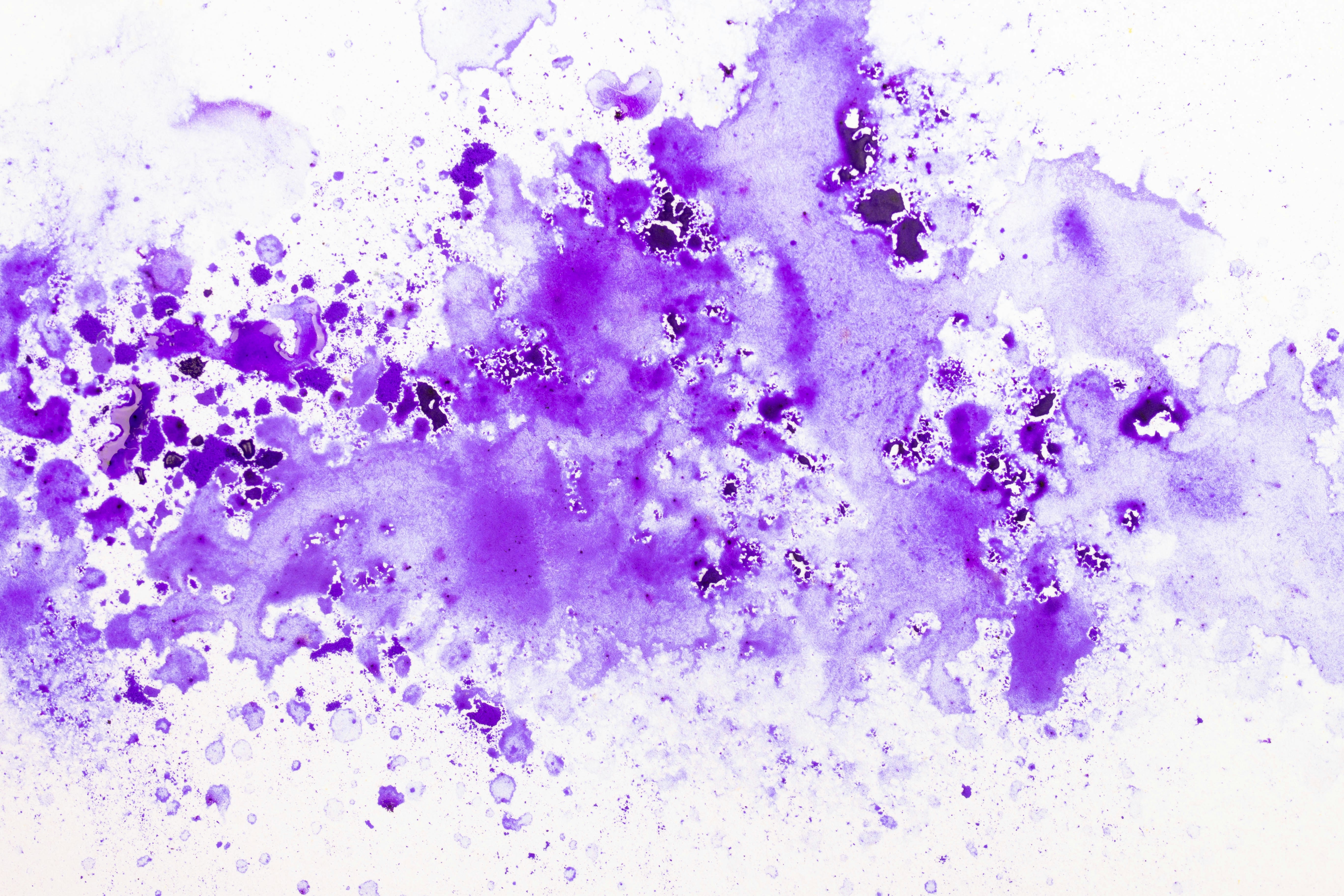 ink stains