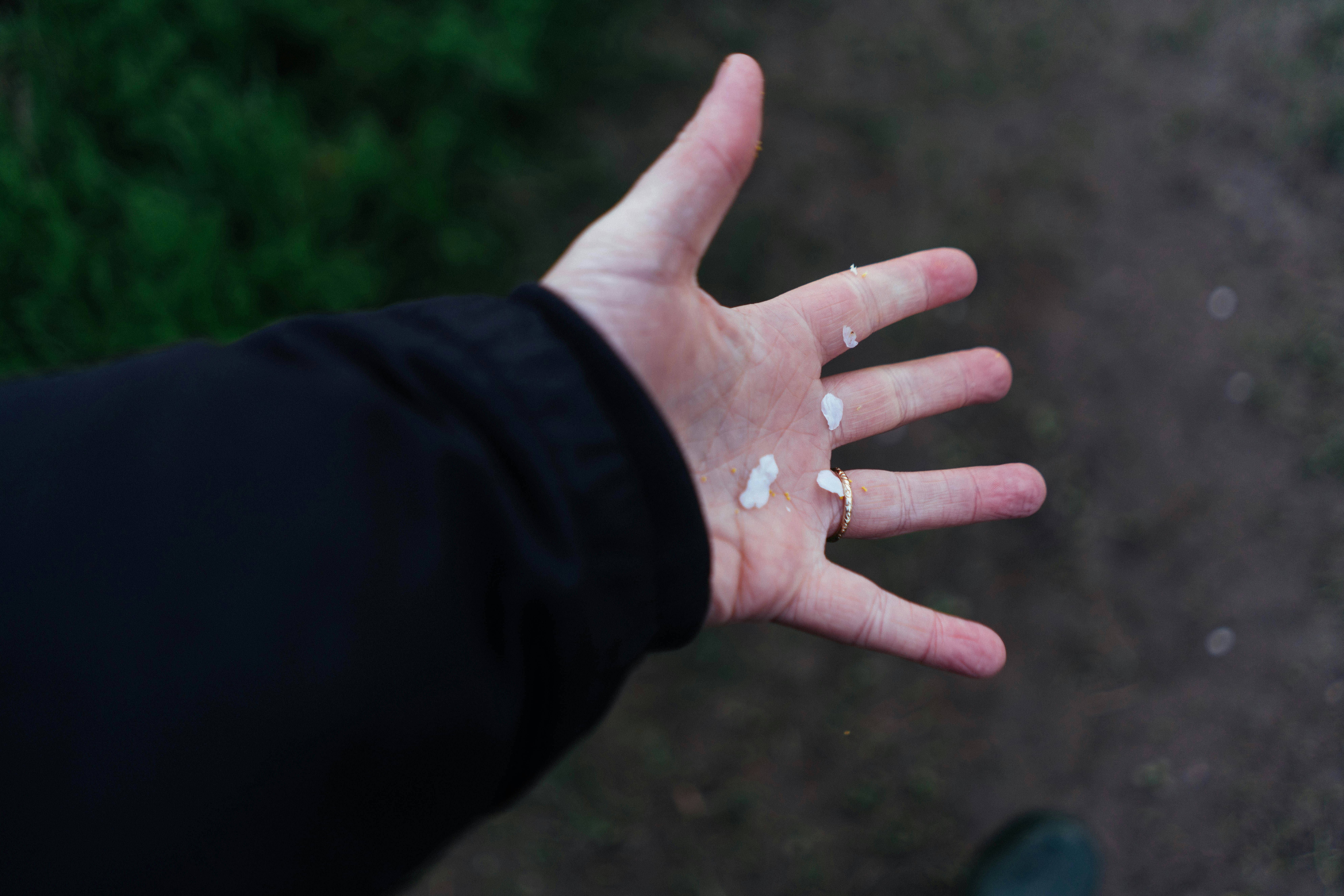 손바닥과 손가락 주변에 흰 점이 있는 손