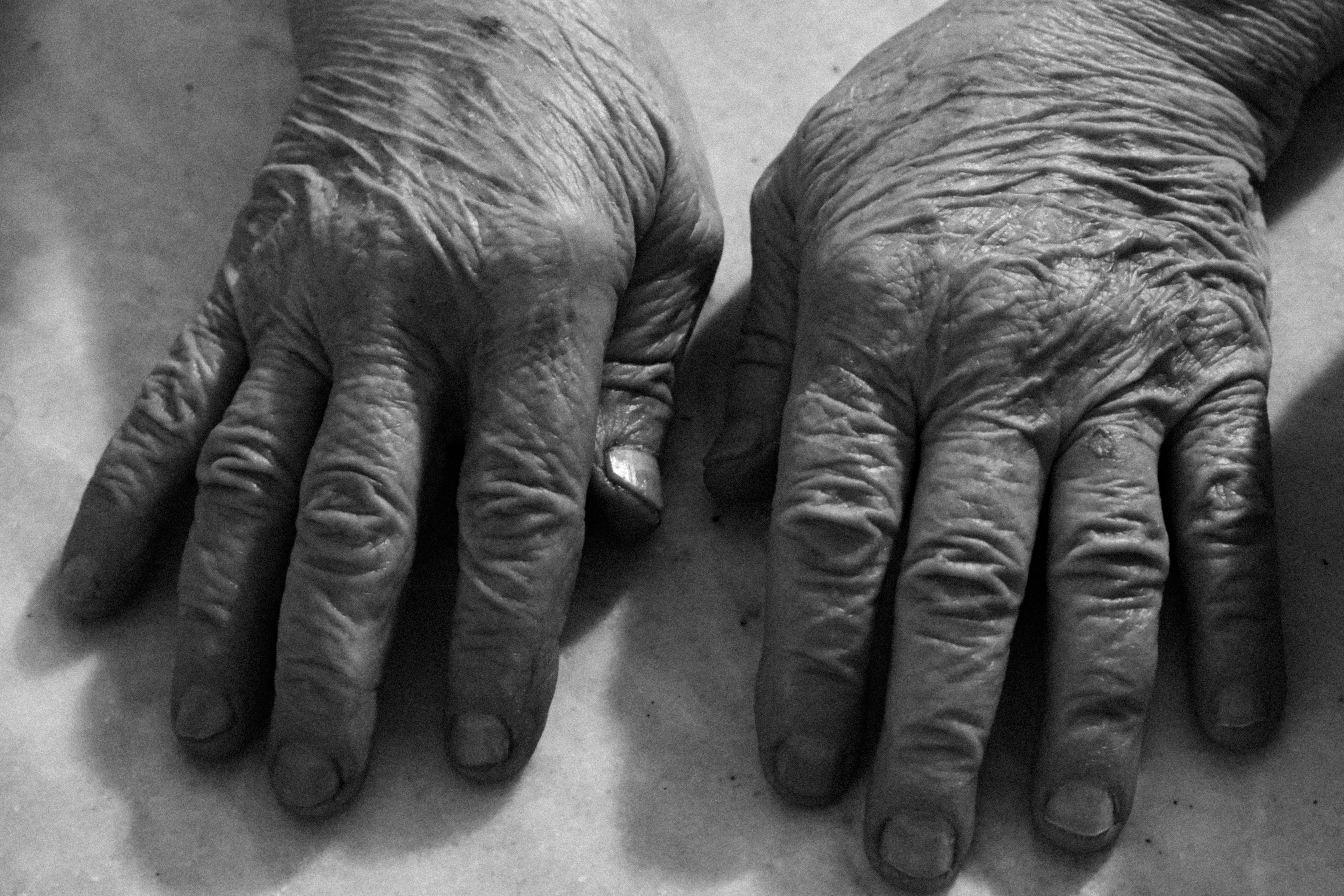 Close-up of elderly wrinkled hands resting on a textured surface.