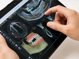 Dentist examining 3D dental scan on tablet