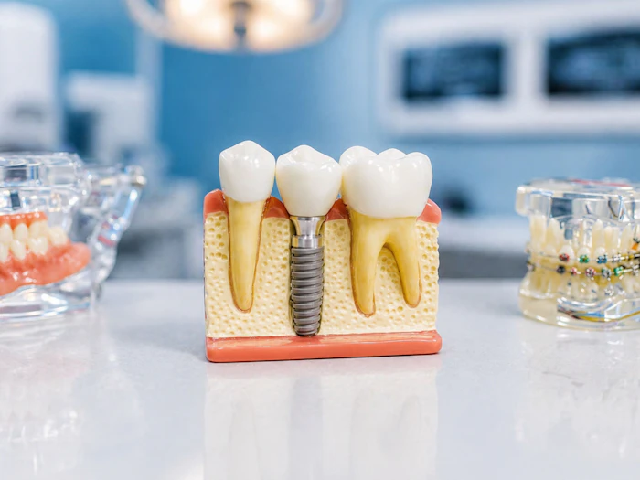 Próteses Dentárias