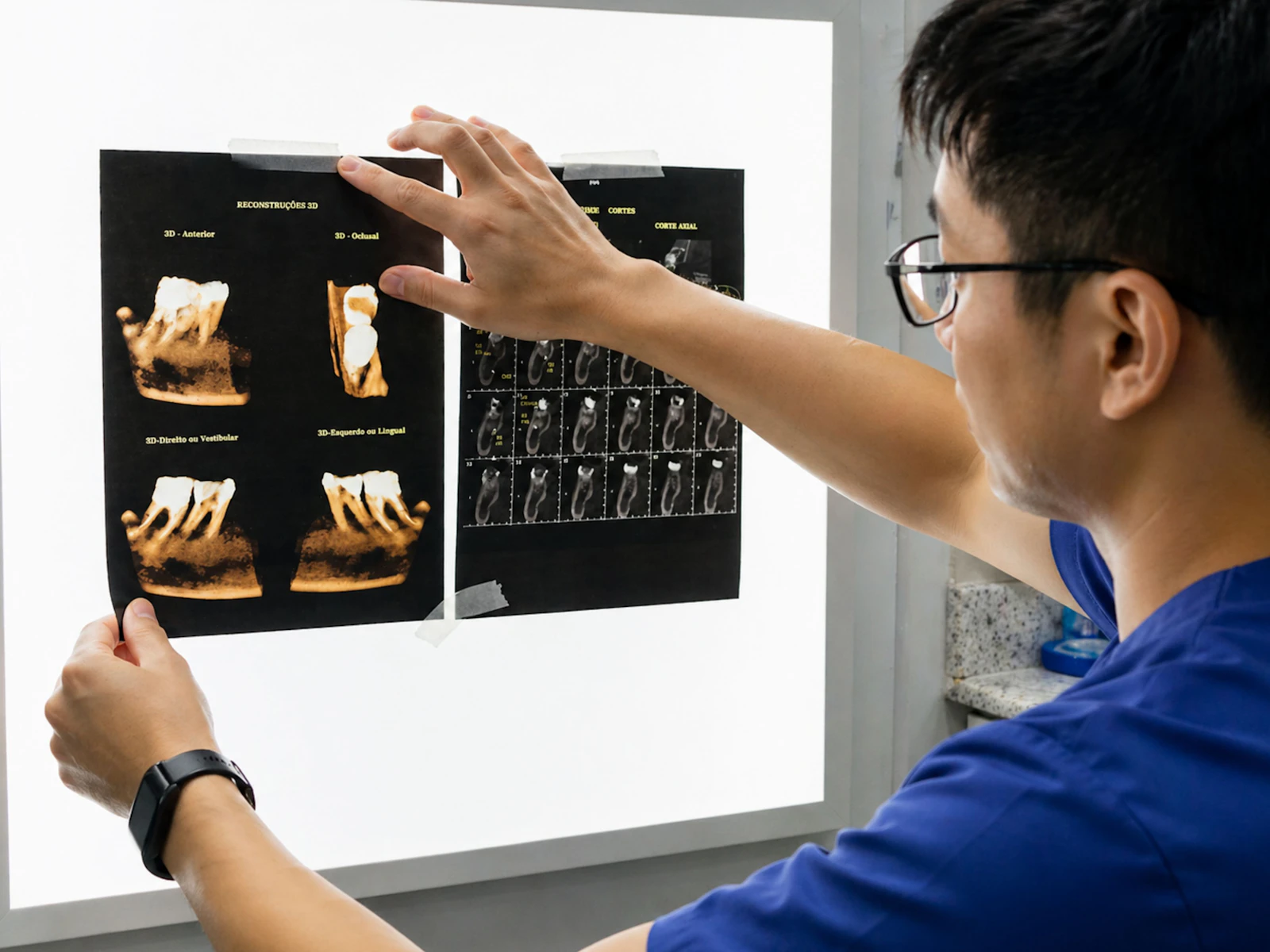 Dentist reviewing dental X-rays while evaluating a tooth