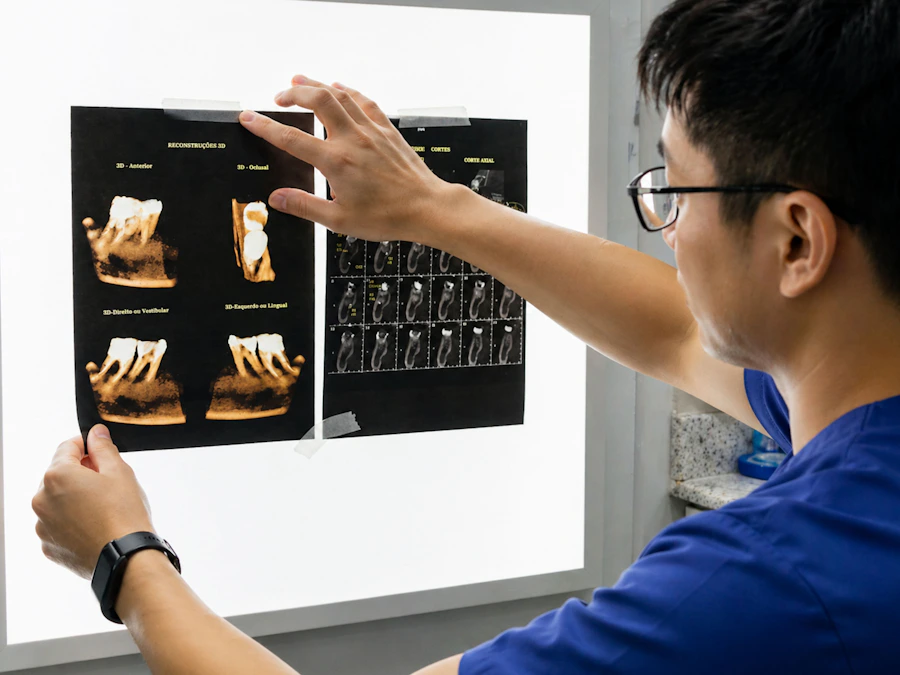 A clinician reviewing dental X-rays on a lightbox