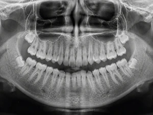 Urgencias — radiografía y tomógrafo