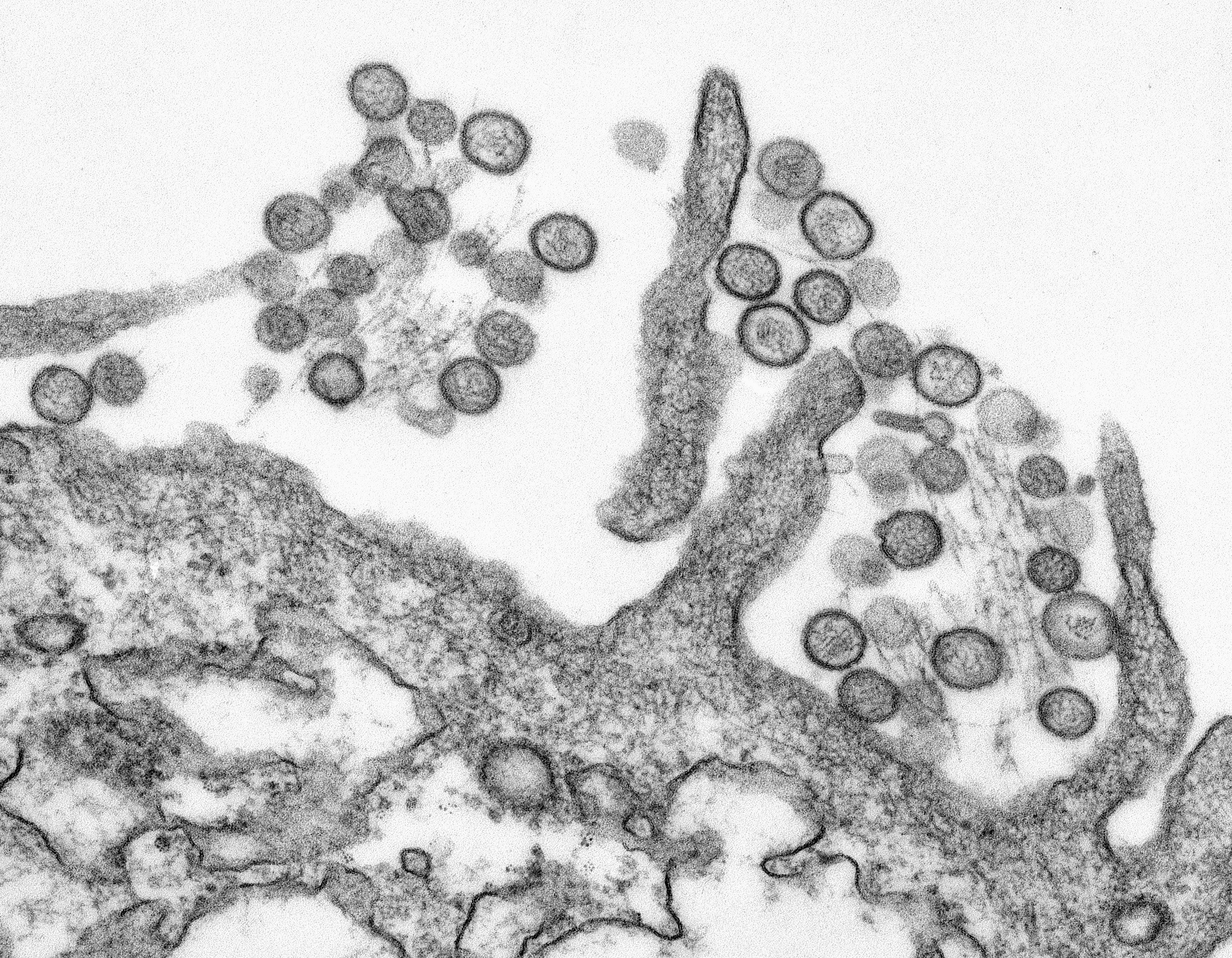 Microscopia eletrônica de vírus brotando a partir de uma membrana celular.