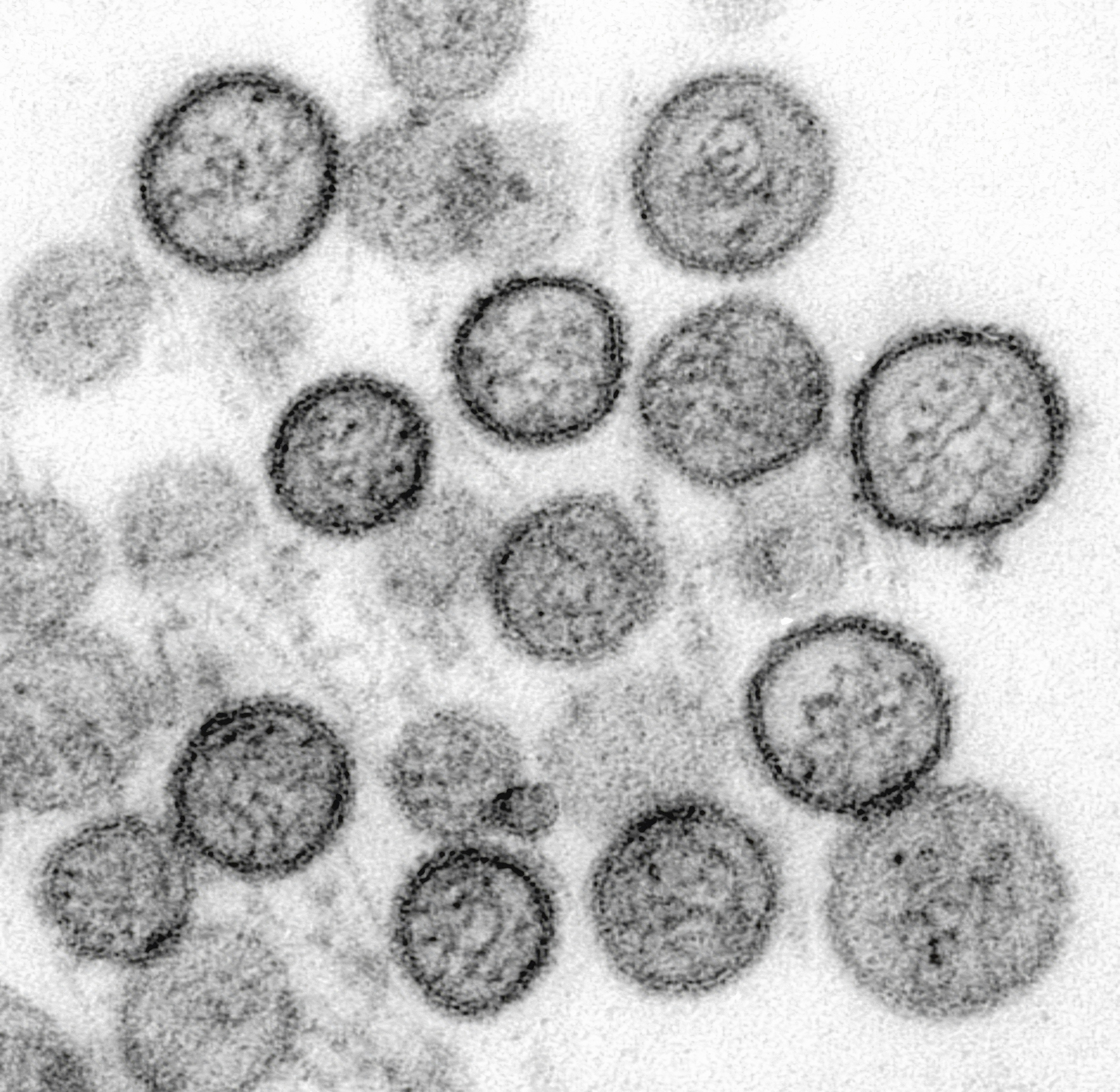 While one study showed hantavirus may be found in semen for years, no research yet confirms this indicates long-term contagiousness